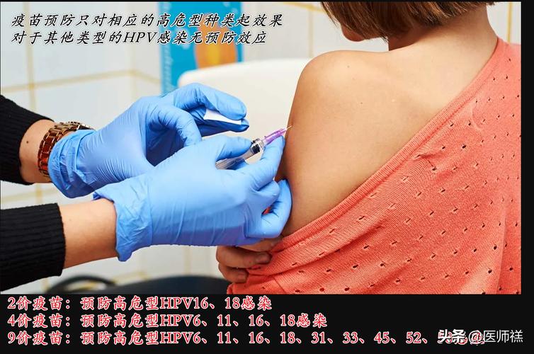 宫颈癌疫苗多少钱二价四价九价哪个值得打